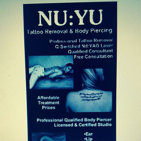 NuyuTattooRemovalBristol