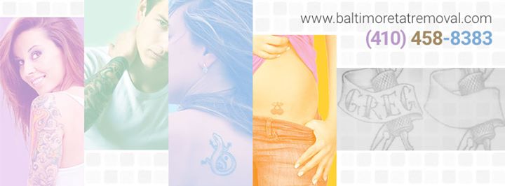BaltimoreTattooRemoval