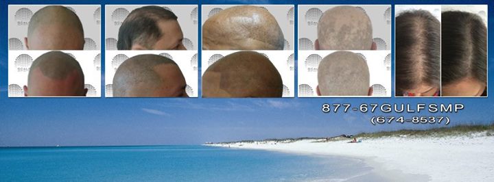 ScalpAestheticsGulfCoast