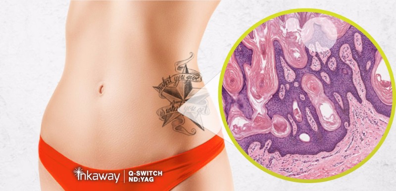 HPT16_inkaway_Girl_cross_Section_V1.1.0-1